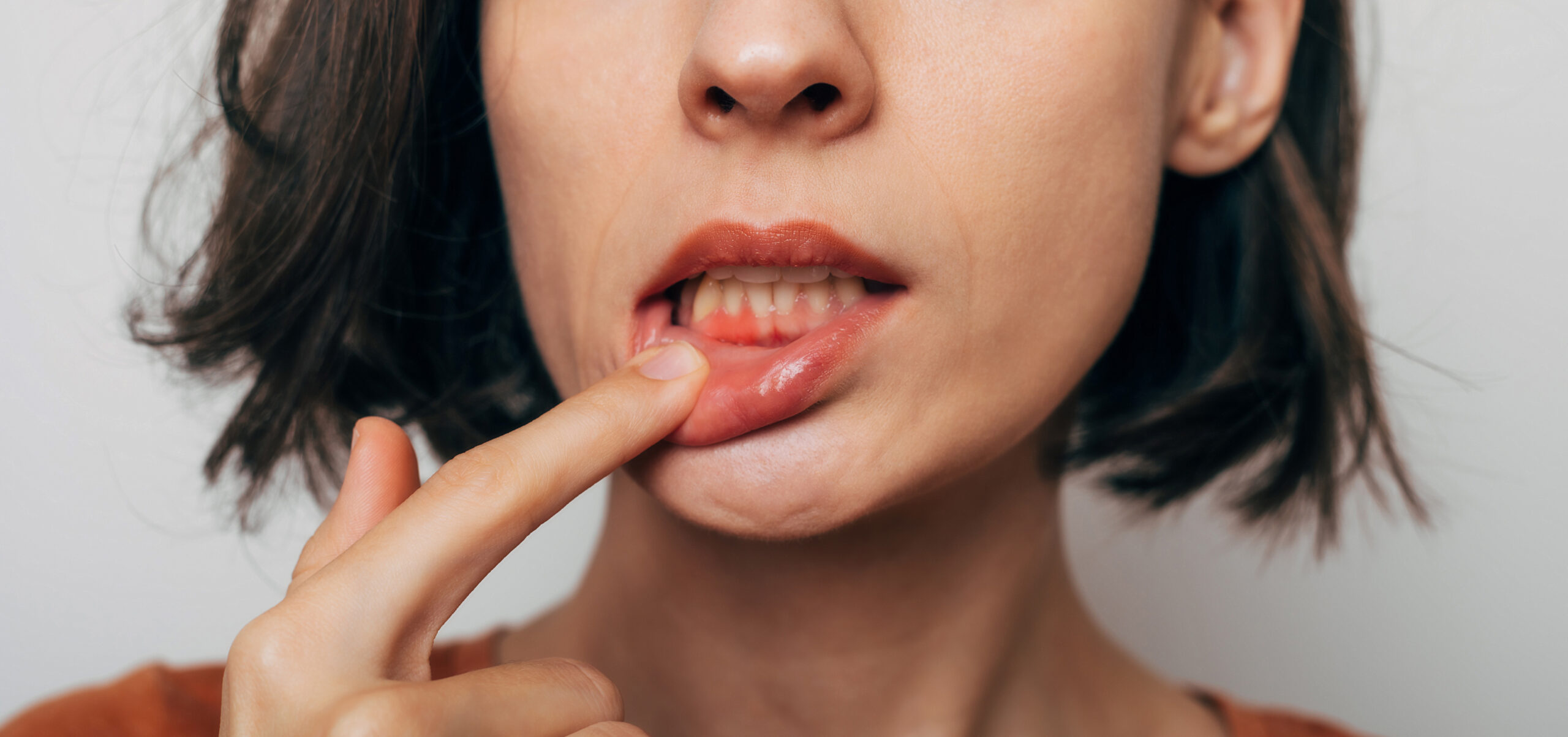 Close up shot of gum inflammation. Cropped shot of a young woman showing red bleeding gums isolated on a gray background. Dentistry, dental care